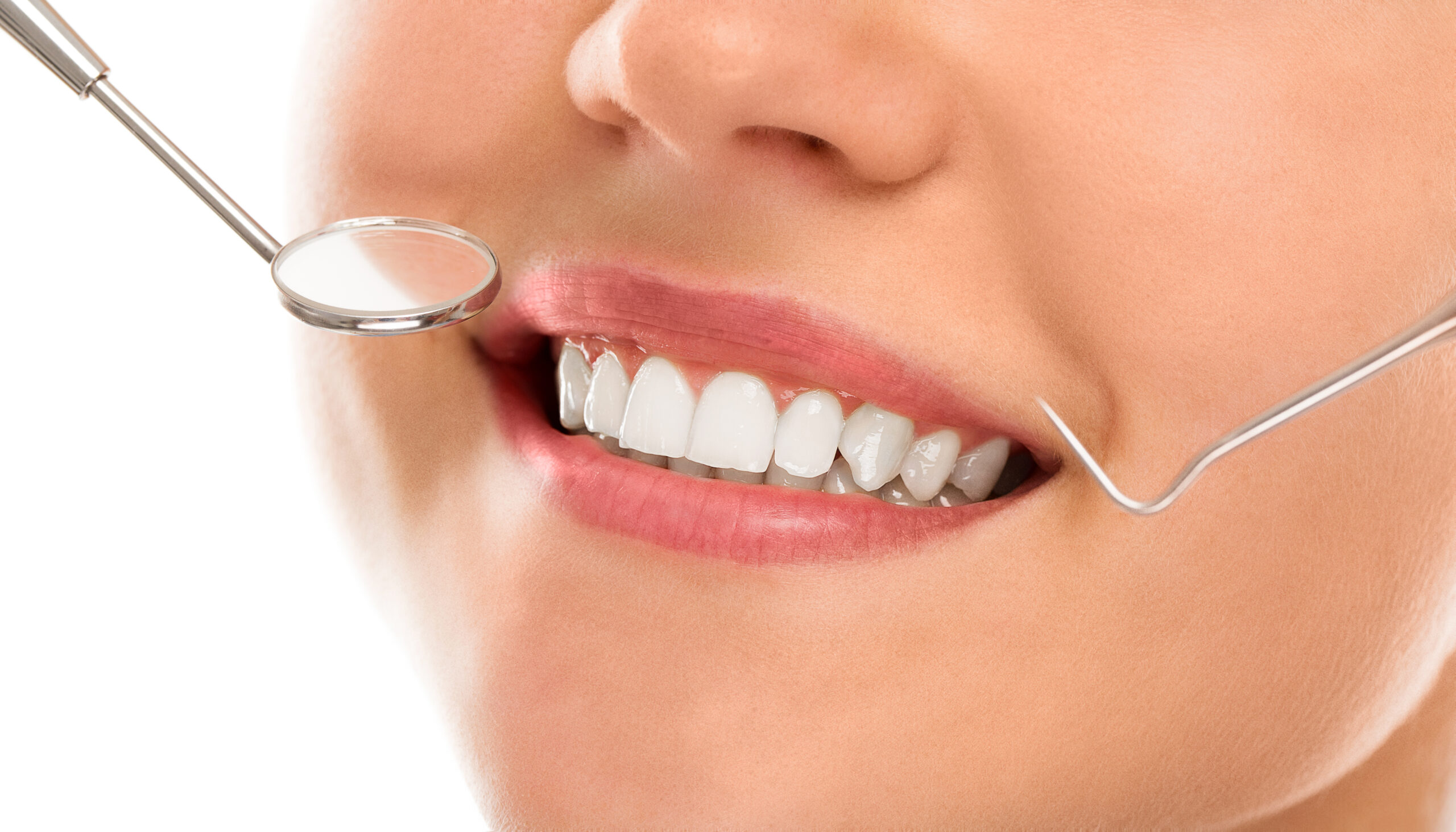 Smile Designing